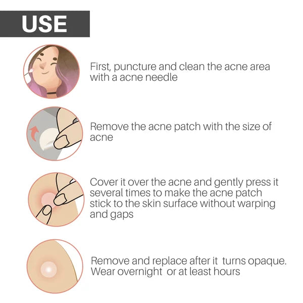 ✨ 2024 Hydrocolloid Acne Cover Patches(🔥Buy 3 Get 3 Free)