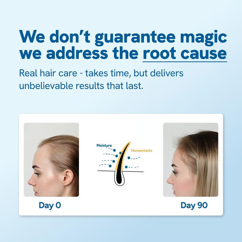 Advanced Hair Growth Roll-On Serum | 3% Rosemary | 2% Aminexil | 3% Redensy l 2% Anagain | Precision Scalp Applicator | Paraben & Sulphate Free | Non oily and mess free