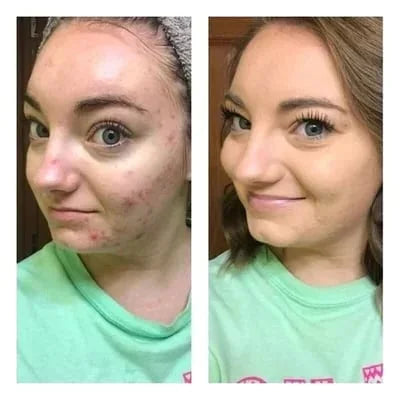 🎁Tri-color concealer - Moisturizing and long-lasting💦