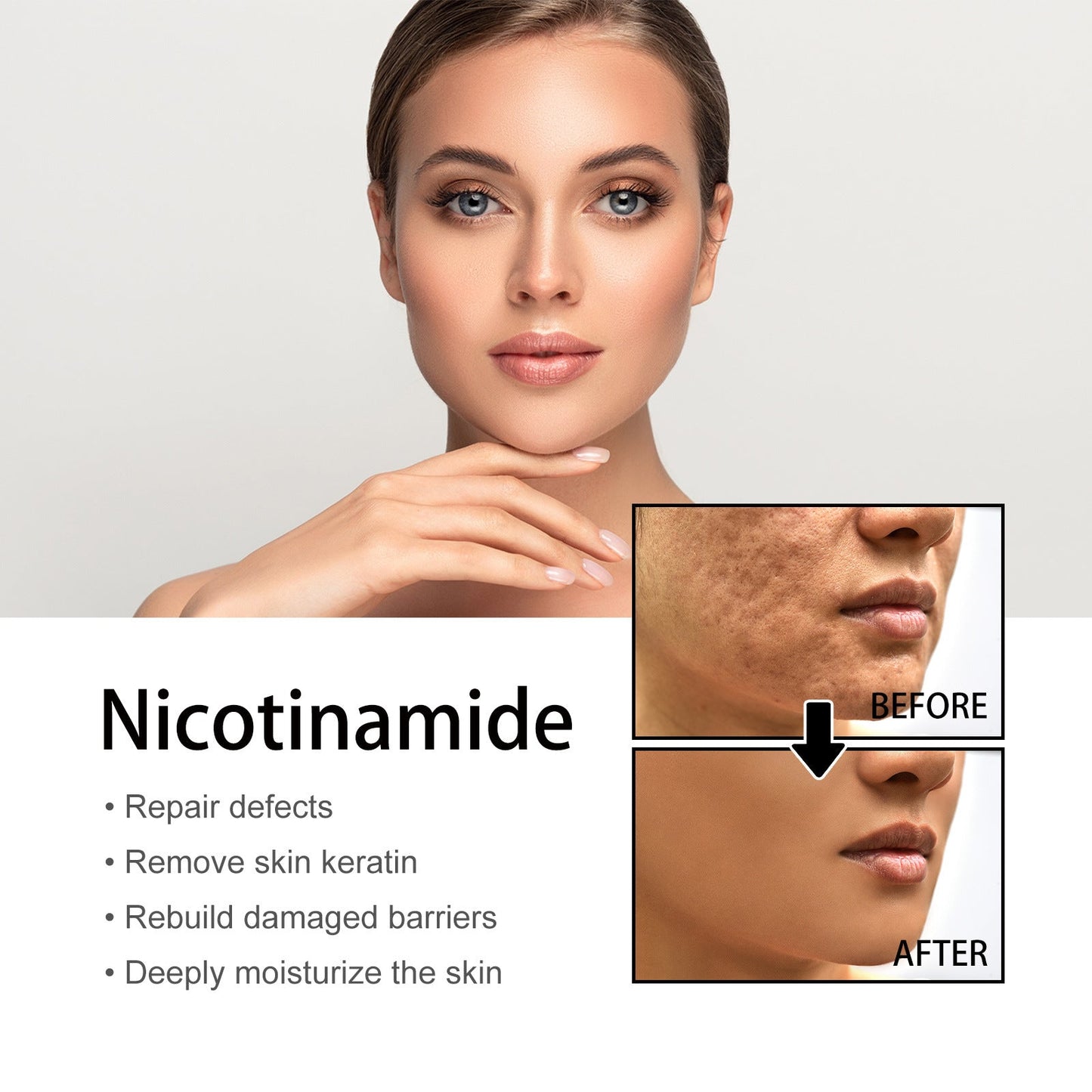 🔥Last Day Promotion 70% OFF-Niacinamide Facial Essence💖