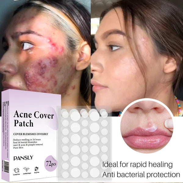 ✨ 2024 Hydrocolloid Acne Cover Patches（🔥Buy 3 Get 3 Free）