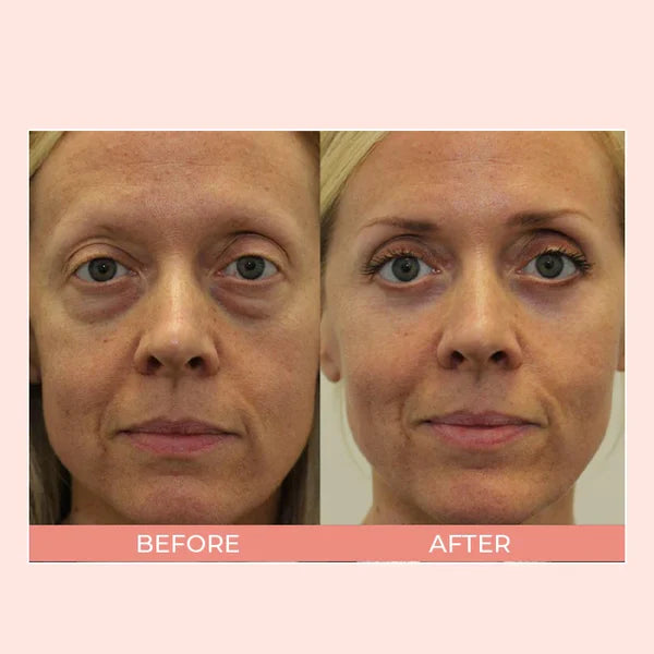 EIASER™ Retinol Polypeptide Repair Eye Cream