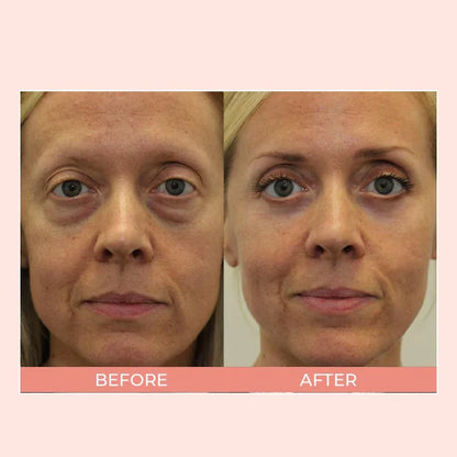 EIASER™ Retinol Polypeptide Repair Eye Cream