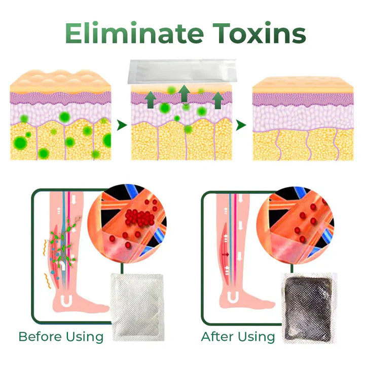 Varicose Vein Relief Herbal Foot Patch