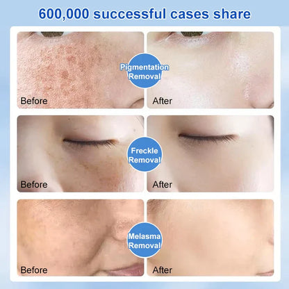 Most Powerful Centennial Whitening Cream-BUY 2 GET 1 FREE( 3 pcs)🔥🔥