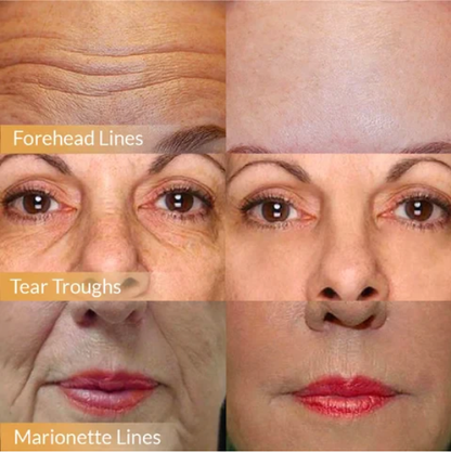 2025 Hot Sale Polypeptide Firming Full Face Cream