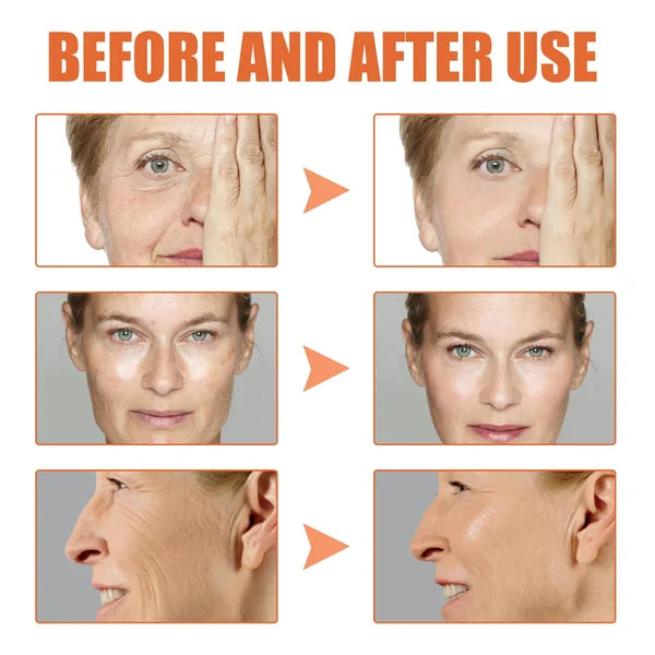 🎉Buy 1 Get 1 Free🎁 - Botox Face Serum