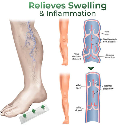 Varicose Vein Relief Herbal Foot Patch