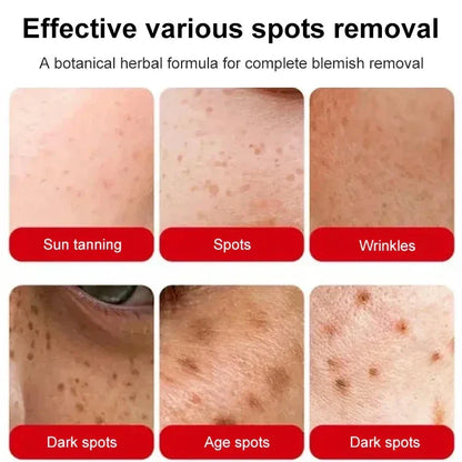 Most Powerful Centennial Whitening Cream-BUY 2 GET 1 FREE( 3 pcs)🔥🔥