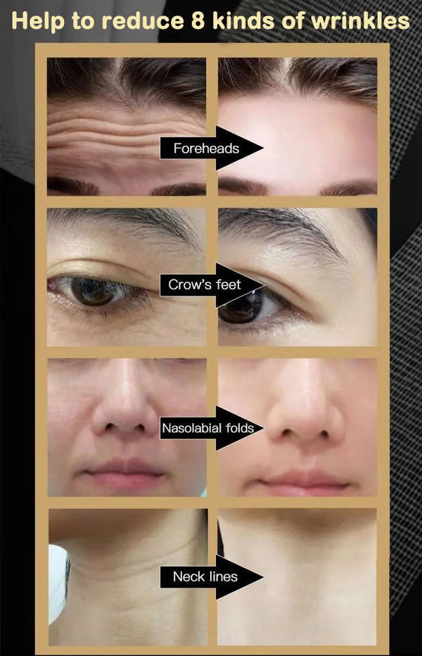 2025 New Anti Wrinkle Face Cream - Improve skin quality & Prevent skin aging & Permanent skin rejuvenation 100 Reviews