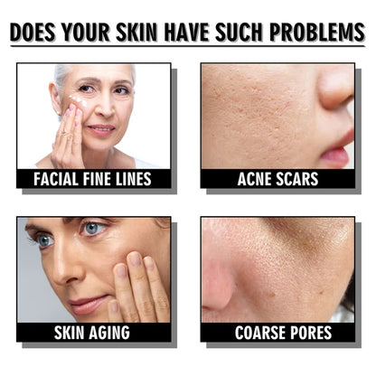 🎁Buy 1 Get 1 Free (2Pcs)🎁 Snail Collagen Lifting Firming Cream