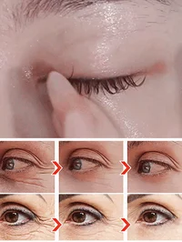 Anti-wrinkle eye serum oil