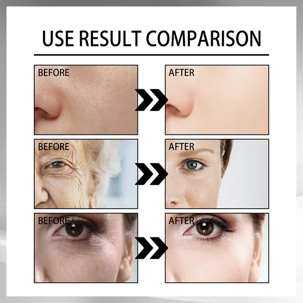 🎁Buy 1 Get 1 Free (2Pcs)🎁 Snail Collagen Lifting Firming Cream