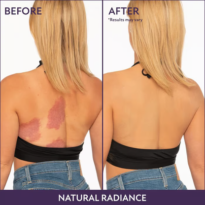 🎉Last Day🎁All Over Complexion Perfector