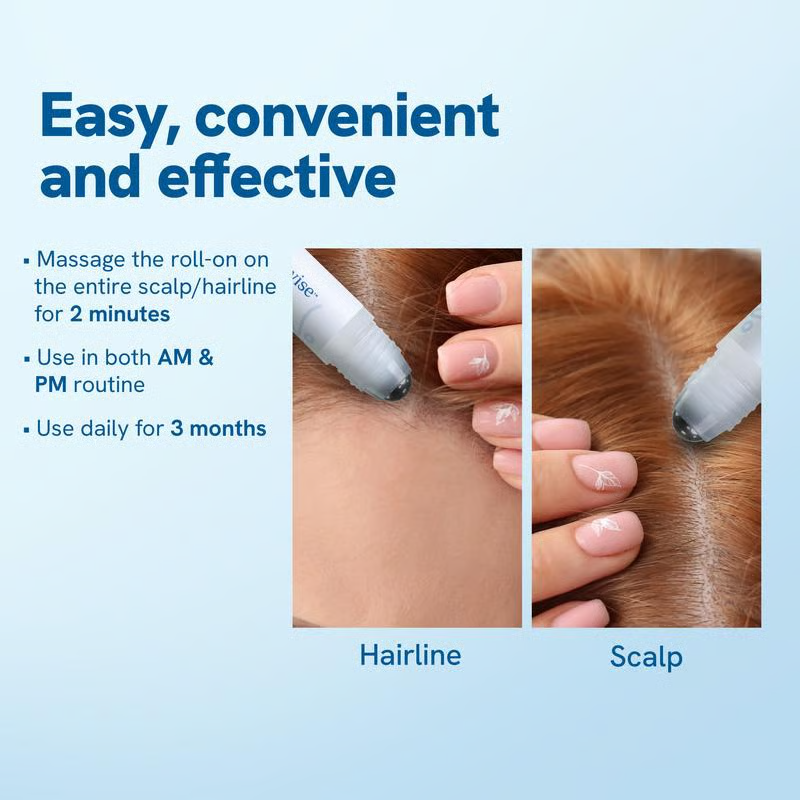 Advanced Hair Growth Roll-On Serum | 3% Rosemary | 2% Aminexil | 3% Redensy l 2% Anagain | Precision Scalp Applicator | Paraben & Sulphate Free | Non oily and mess free