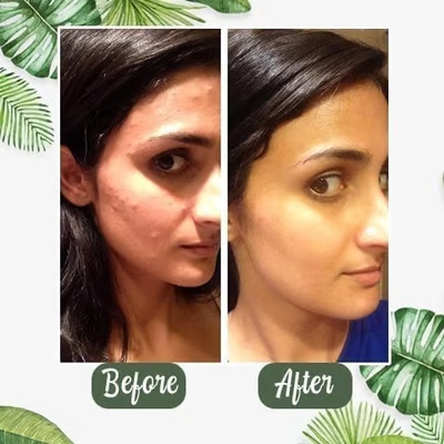 🍵 Deep Cleanse Green Tea Mask