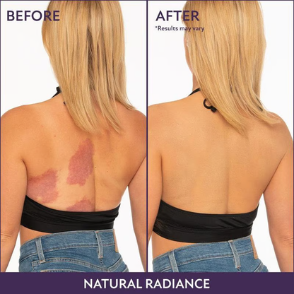 ✨ Body Coverage Perfector – Waterproof, lightweight & flawless body makeup