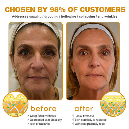 (🐝Made and Shipped from USA✅)  Botox Bee Venom Wrinkle Removal Cream- LAST DAY 70% OFF